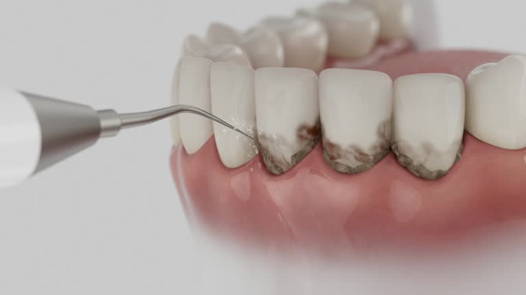 Trusted Teeth Cleaning And Checkup service in Moreauville, LA - Dentist Open Now